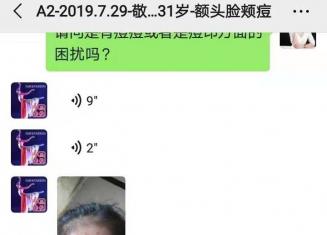 額頭上的閉合性粉刺怎么去除？分享下舞蹈老師敬敬的經驗