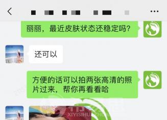 兩個腮邊長痘痘是怎么回事？腮邊反復長痘如何祛除？